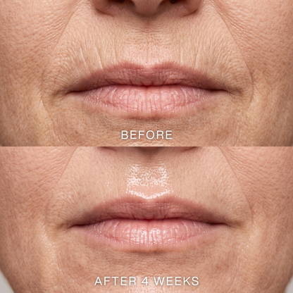 3% Hyaluronic Acid Serum