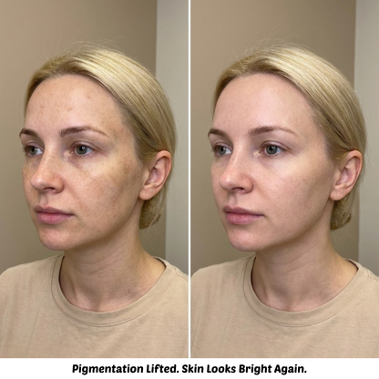 Turmeric & Kojic Acid Cleanse Wash