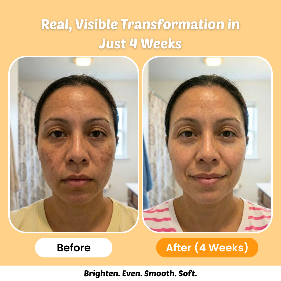 Turmeric & Kojic Acid Cleanse Wash