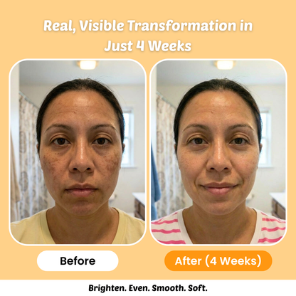 Turmeric & Kojic Acid Cleanse Wash